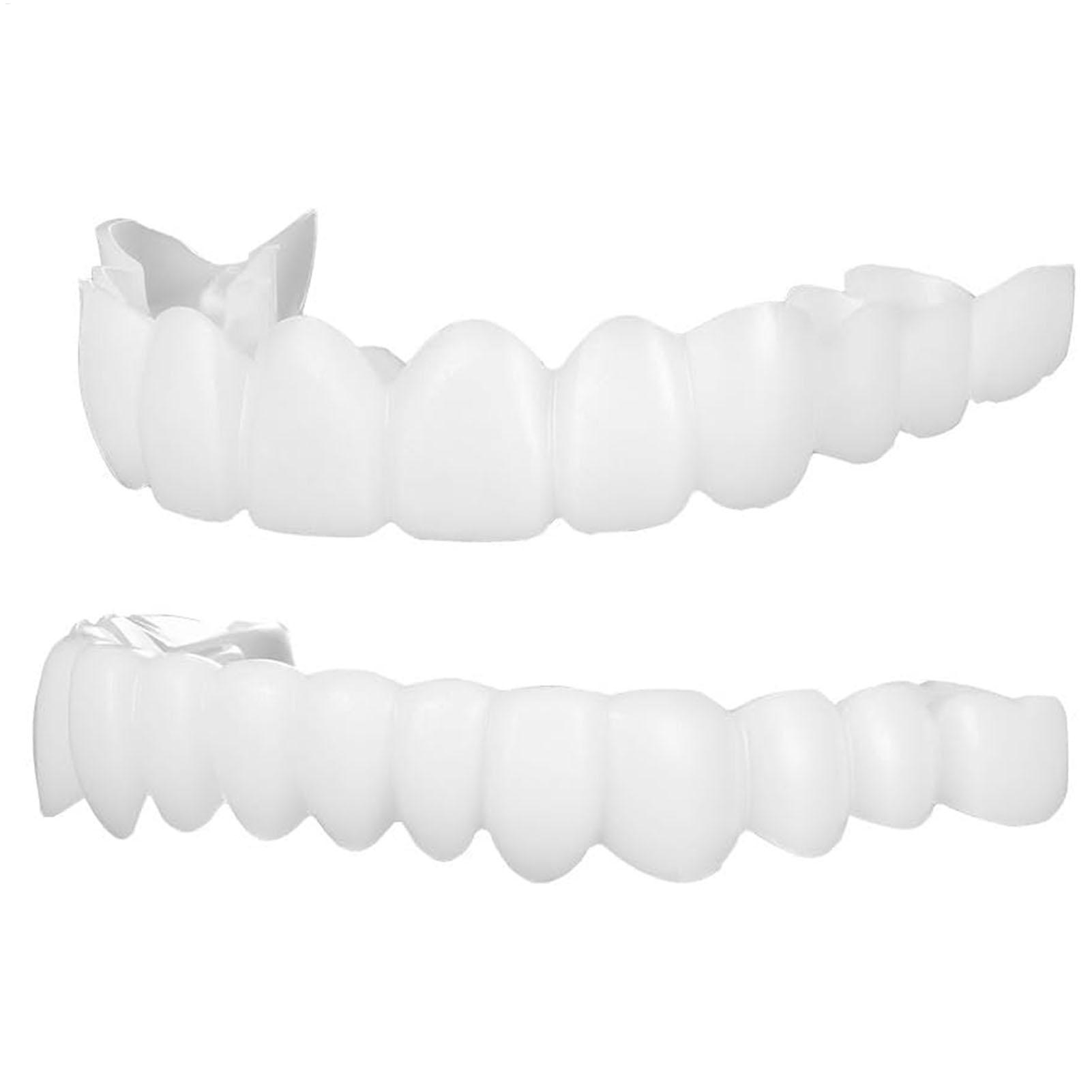 Teeth Whitening Moulds - 1 Pair SnapsOn Teeth Veneers Brightening