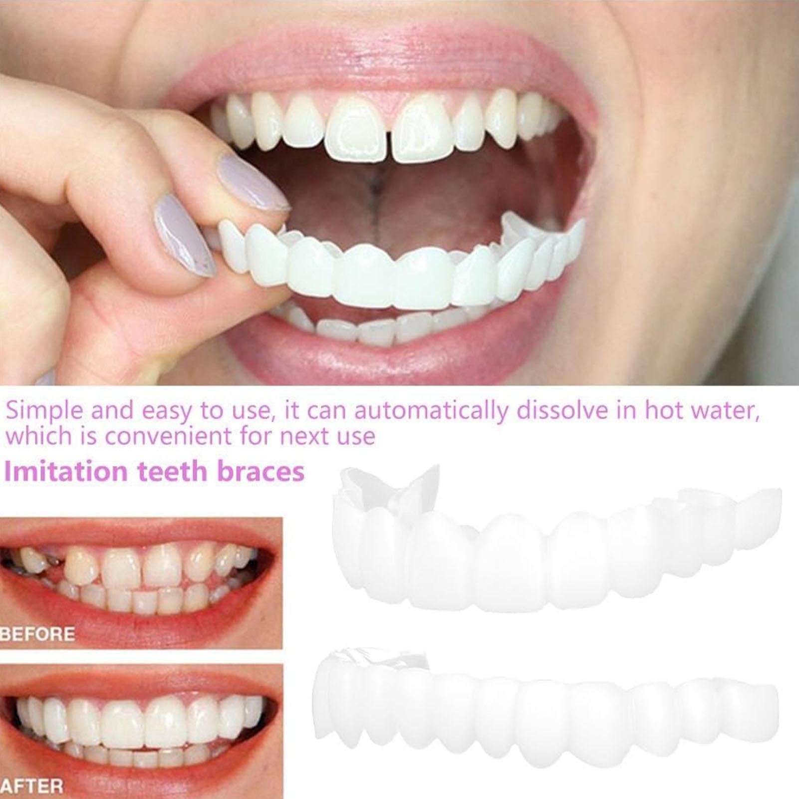 Teeth Whitening Moulds - 2pcs Men Women Temporary Teeth Veneers