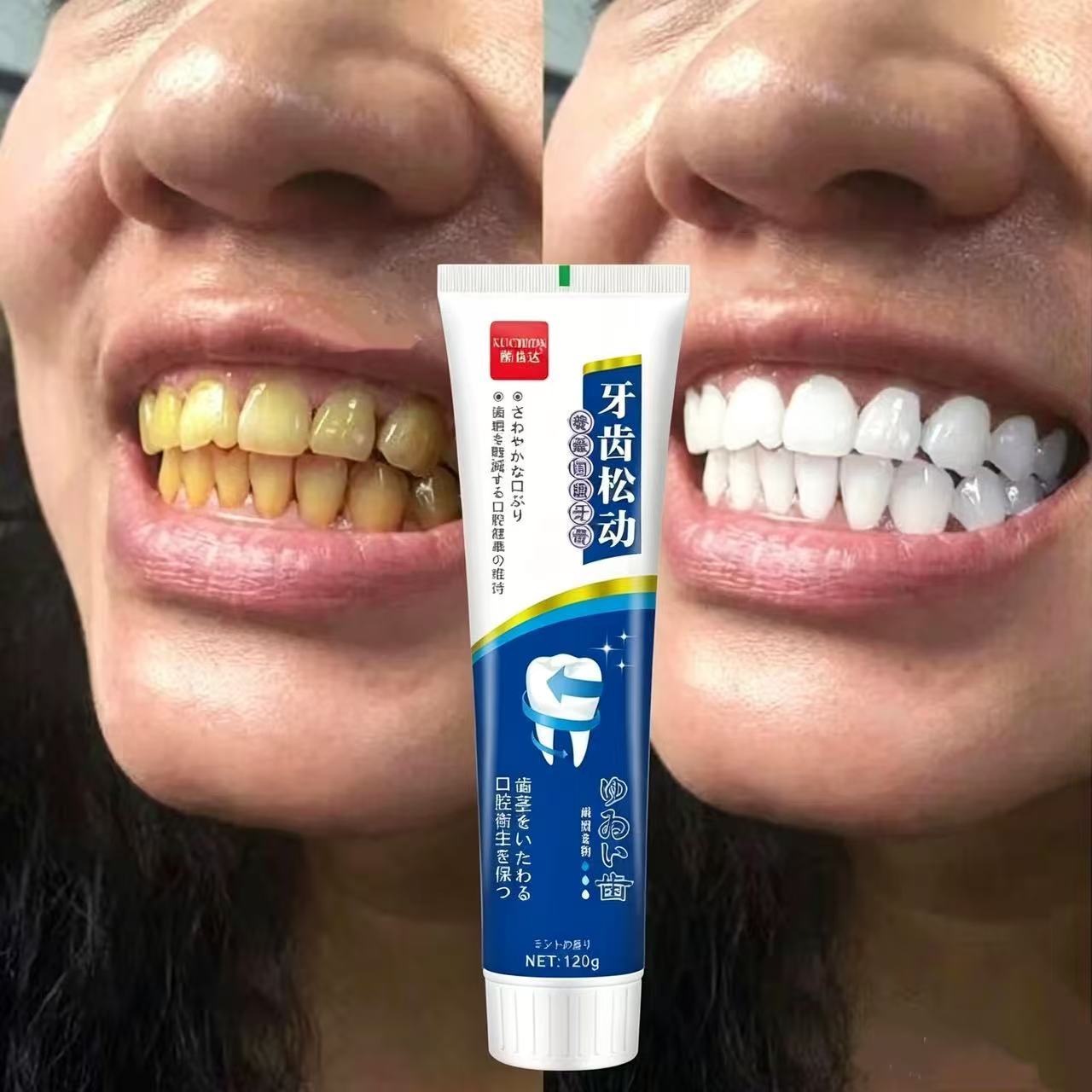 Fix Loose Teeth Japanese Impor - Teeth Whitening Japan review and price