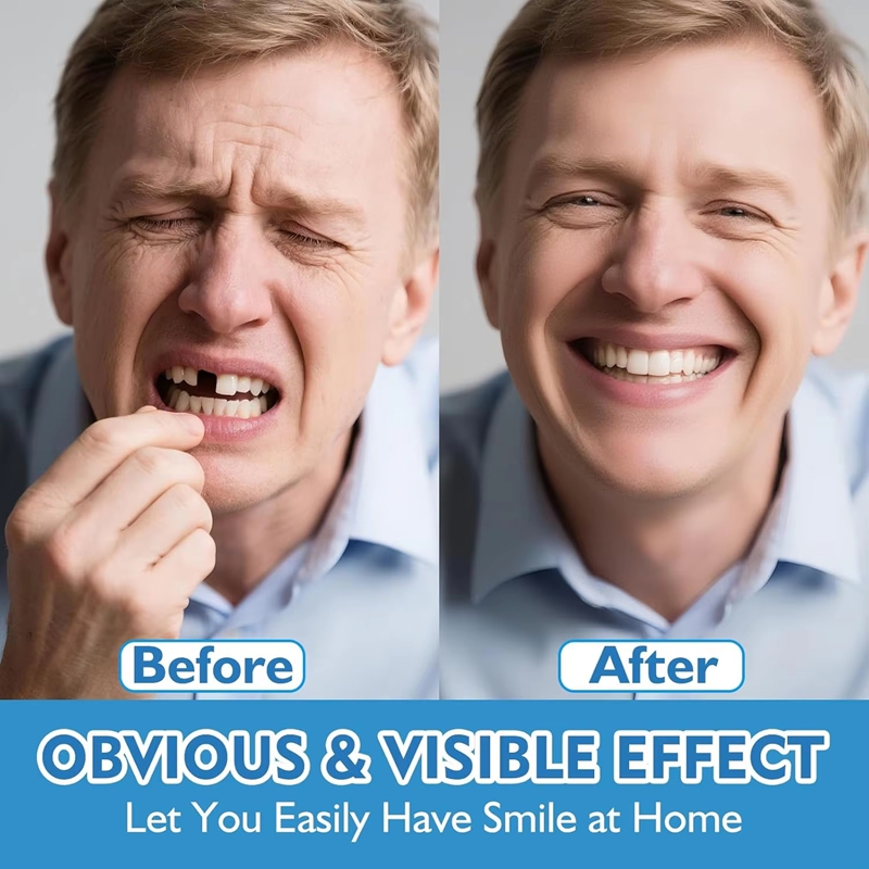 Full Set Silicone Dentures Upp - Teeth Whitening Moulds review and price