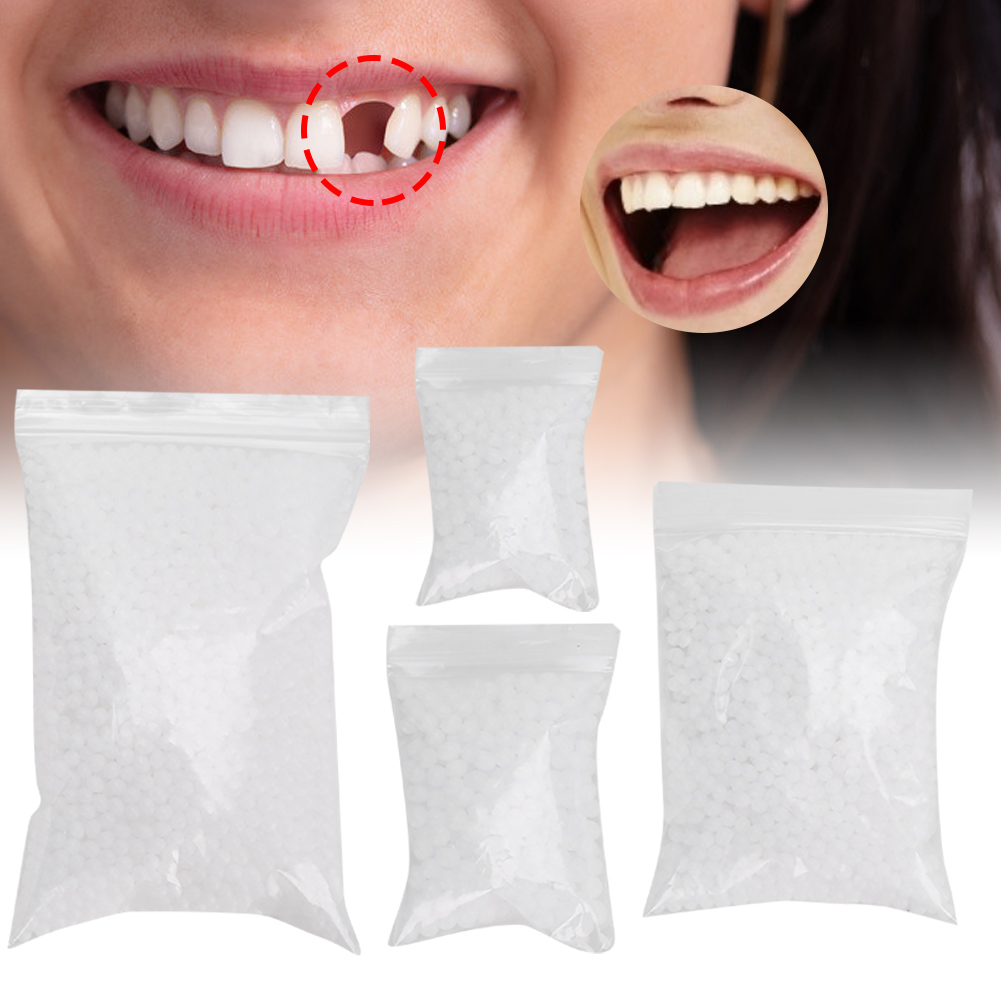 Tooth Repair Bead Broken Teeth - Teeth Whitening Moulds review and price