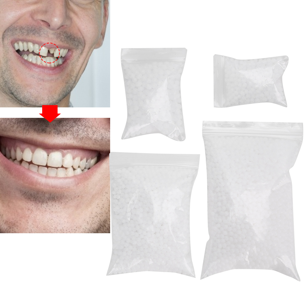 Tooth Repair Bead Broken Teeth - Teeth Whitening Moulds review and price