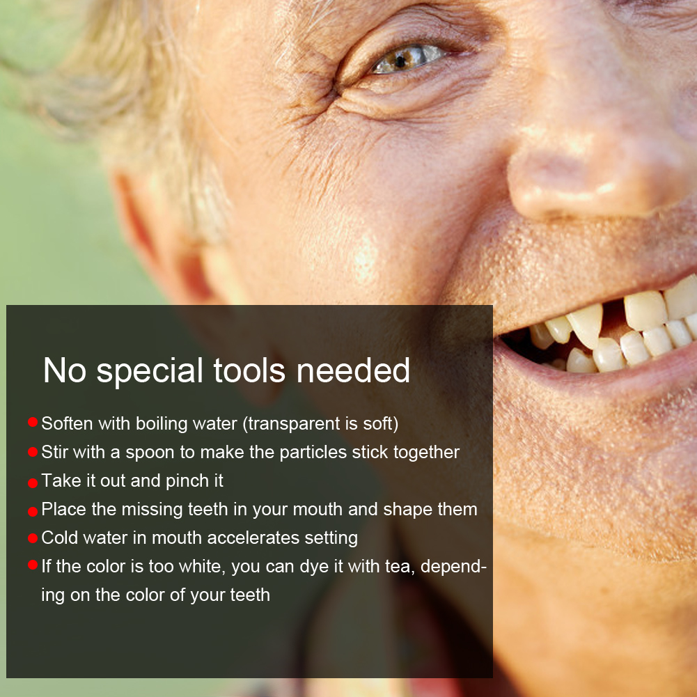 Tooth Repair Bead Broken Teeth - Teeth Whitening Moulds review and price