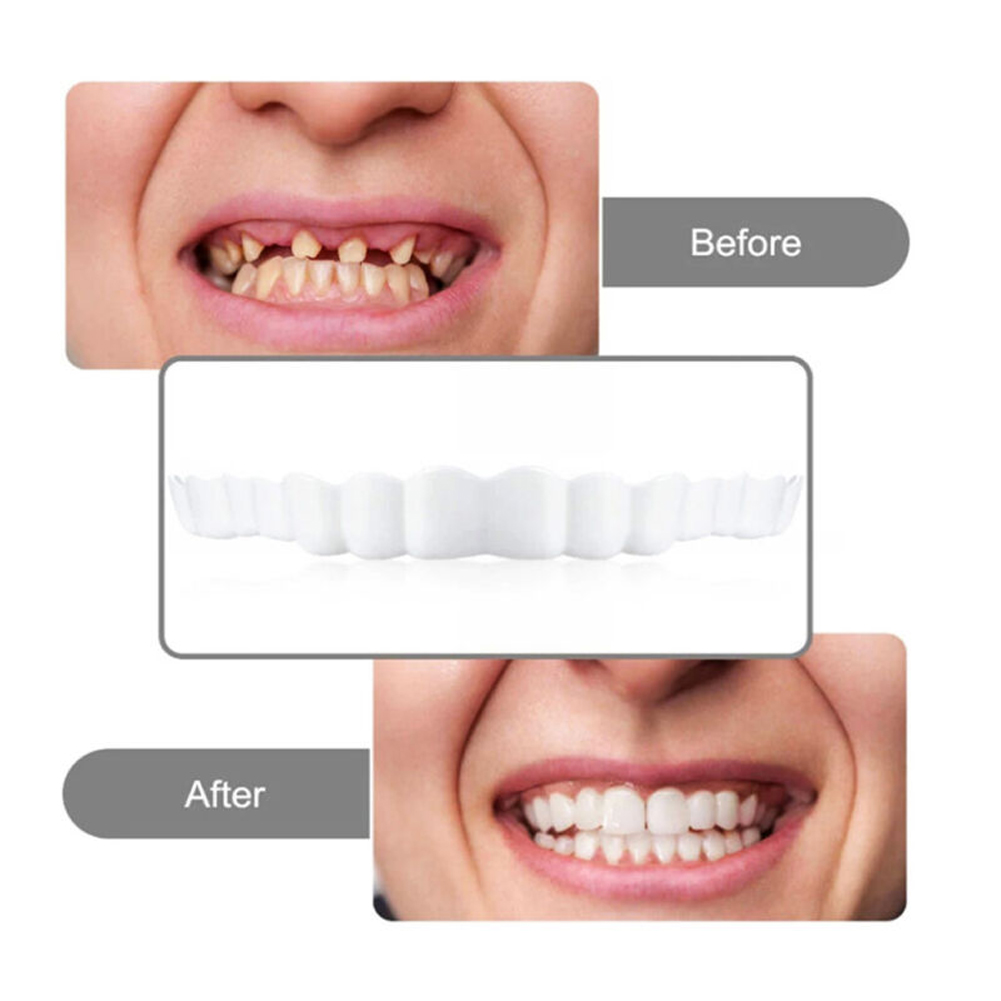 4-6 Pairs Upper&Lower Jaw Dent - Teeth Whitening Moulds review and price