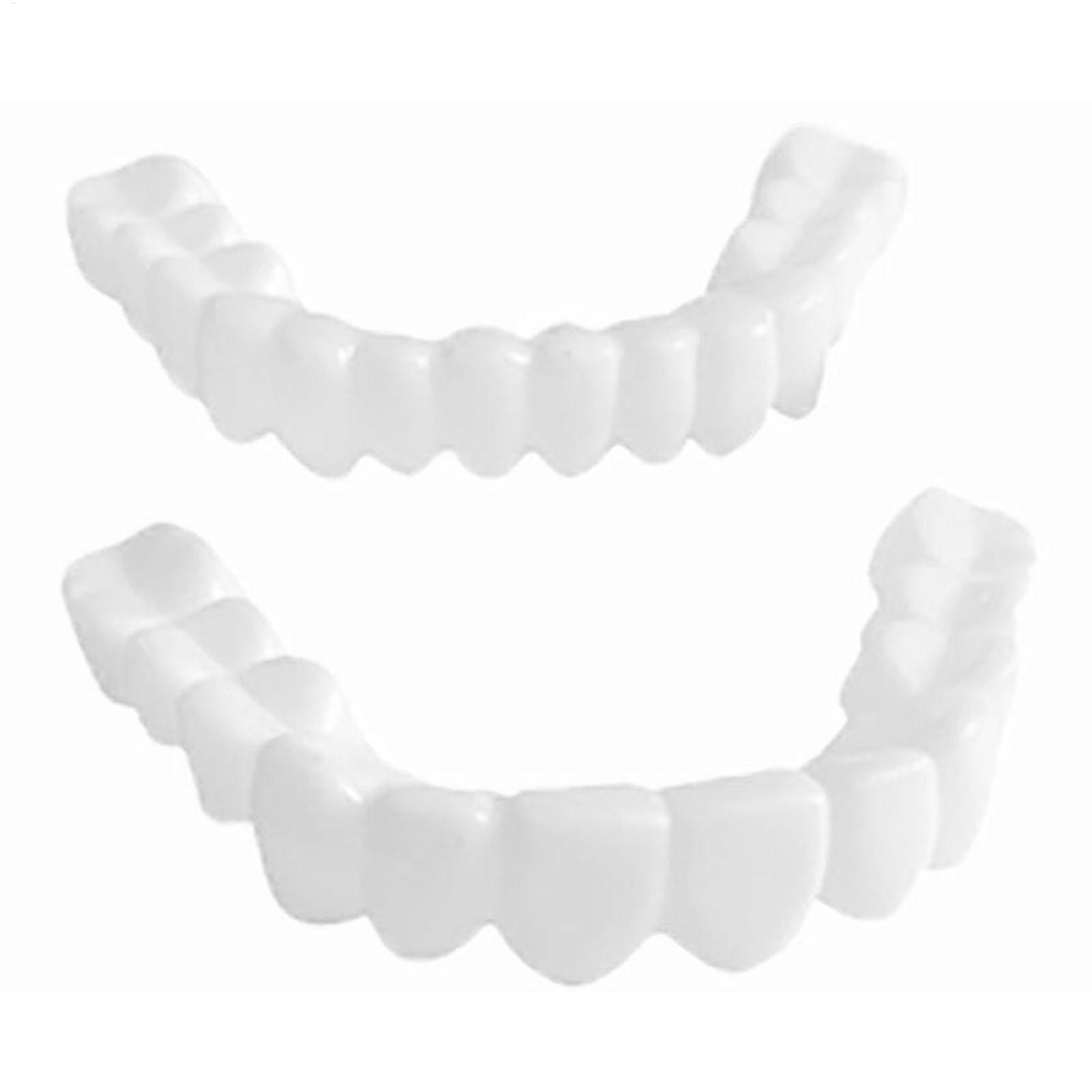 1 Pair SnapsOn Teeth Veneers B - Teeth Whitening Moulds review and price