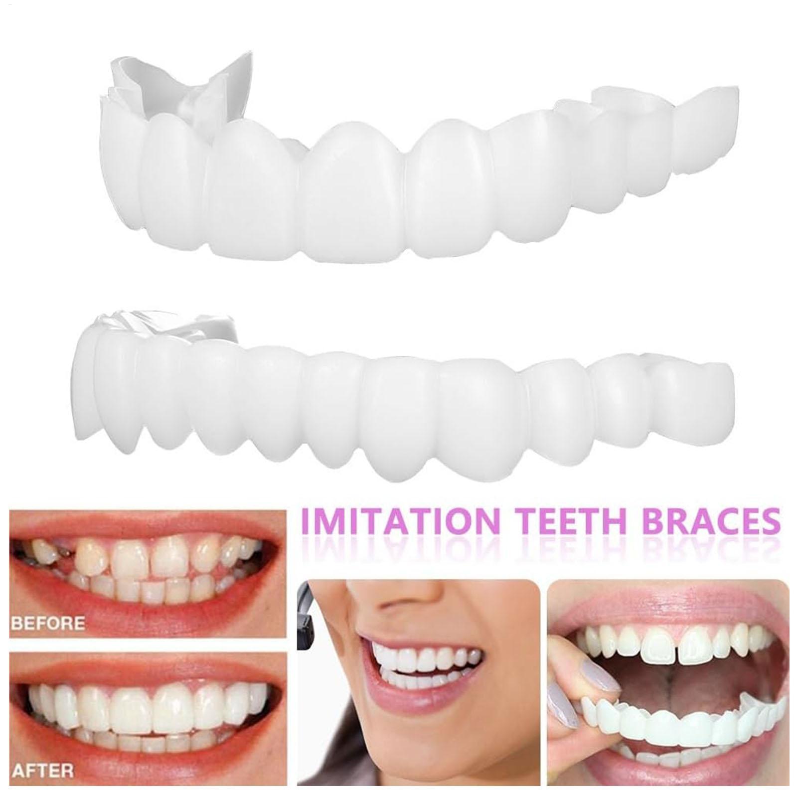 1 Pair SnapsOn Teeth Veneers B - Teeth Whitening Moulds review and price