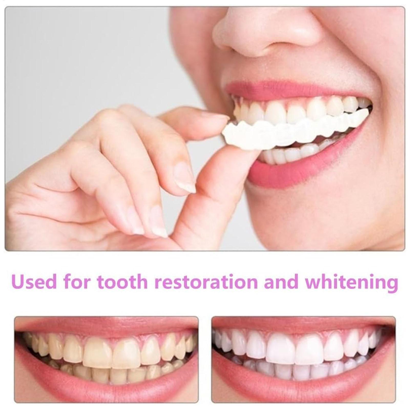 2pcs Men Women Temporary Teeth - Teeth Whitening Moulds review and price