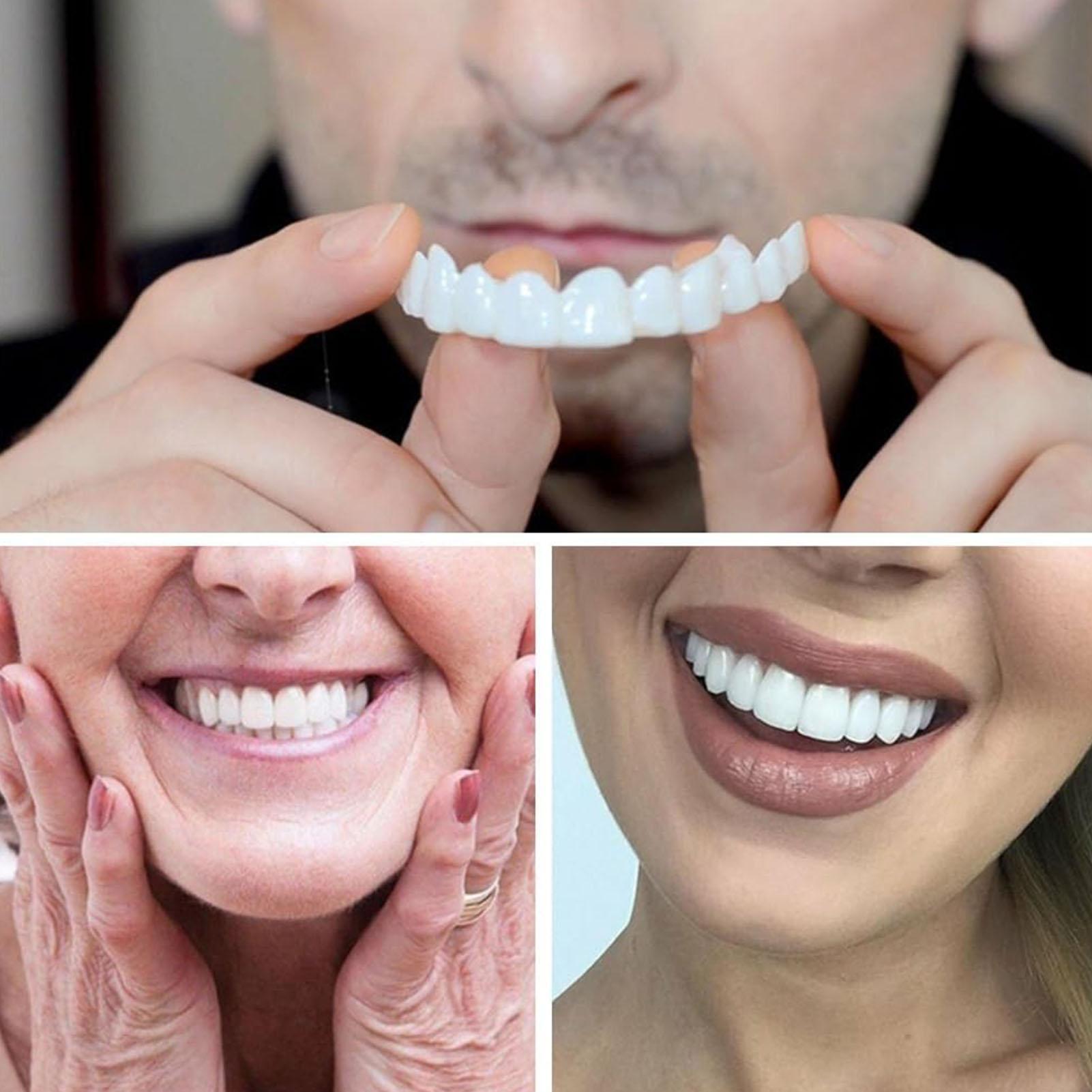 2pcs Men Women Temporary Teeth - Teeth Whitening Moulds review and price
